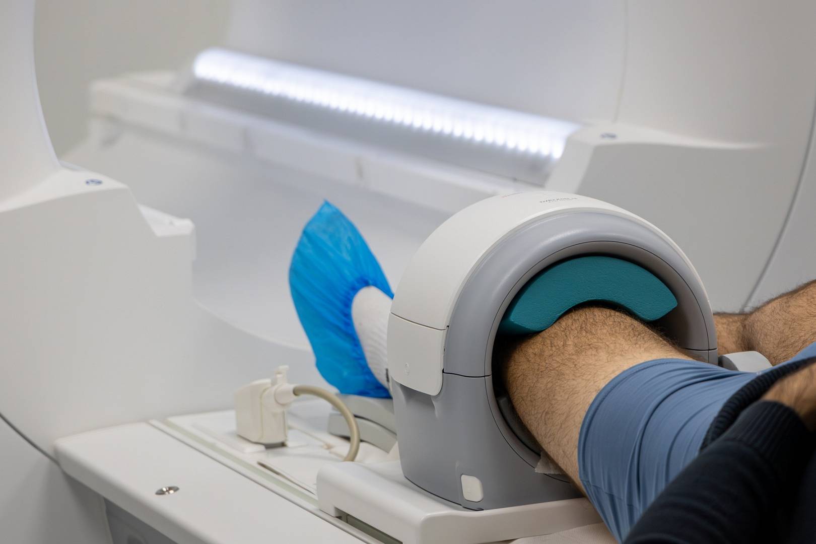 Obrzęk szpiku kostnego w kolanie widoczny w badaniach obrazowych – rezonans magnetyczny stawu kolanowego i uwidocznienie zmian w tkance kostnej.